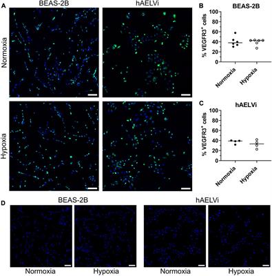 Effects of hypoxia on bronchial and alveolar epithelial cells linked to pathogenesis in chronic lung disorders